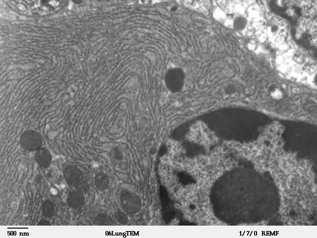 De bølgede linjer i dette billede er det "endoplasmatiske reticulum" i en celle - lageret for valcium. Ryanodinreceptorer findes på disse strukturer.  