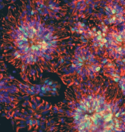 Menneskelige embryonale stamceller vokser i en dyrkningsskål  
