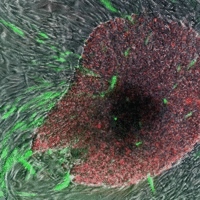 'Inducerede pluripotente stamceller' i grøn og rød, som gror ud fra hudceller der omgiver dem  