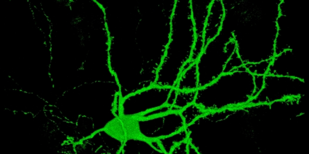 At omdanne hudceller til hjerneceller: et gennembrud for forskningen i Huntingtons Sygdom?