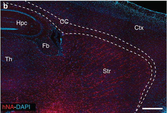 På dette billede, taget fra det originale studie, repræsenterer de røde prikker humane gliaceller i en voksen musehjerne - teksten og linjerne indikerer forskellige hjerneregioner.   