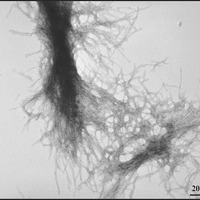 Et billede af oprensede aggregater med mutant huntingtinprotein dannet i laboratoriet. Disse klumper af protein findes også i hjerneceller hos folk med HS.   