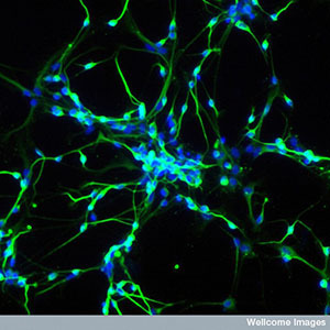 Stamceller kan bruges til at dyrker neuroner i laboratoriet. Disse neuroner er gode redskaber til at studere sygdomme som HD.  